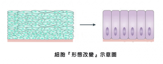 巴瑞特氏食道 Barrett S Esophagus Be 胃食道逆流 食道癌前病變 食道腺癌 李宜霖胃腸肝膽科