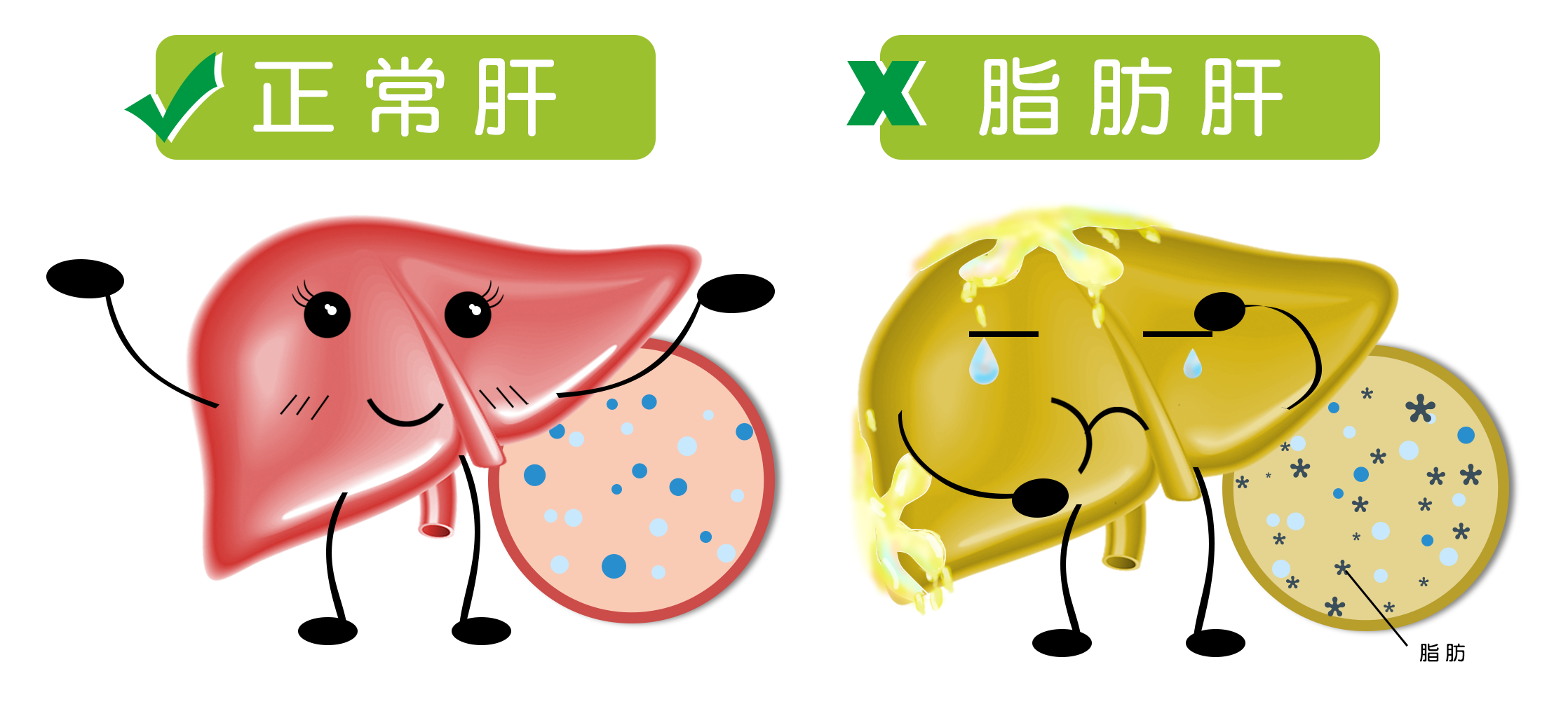 脂肪肝、肥胖、減肥| 李宜霖胃腸肝膽科