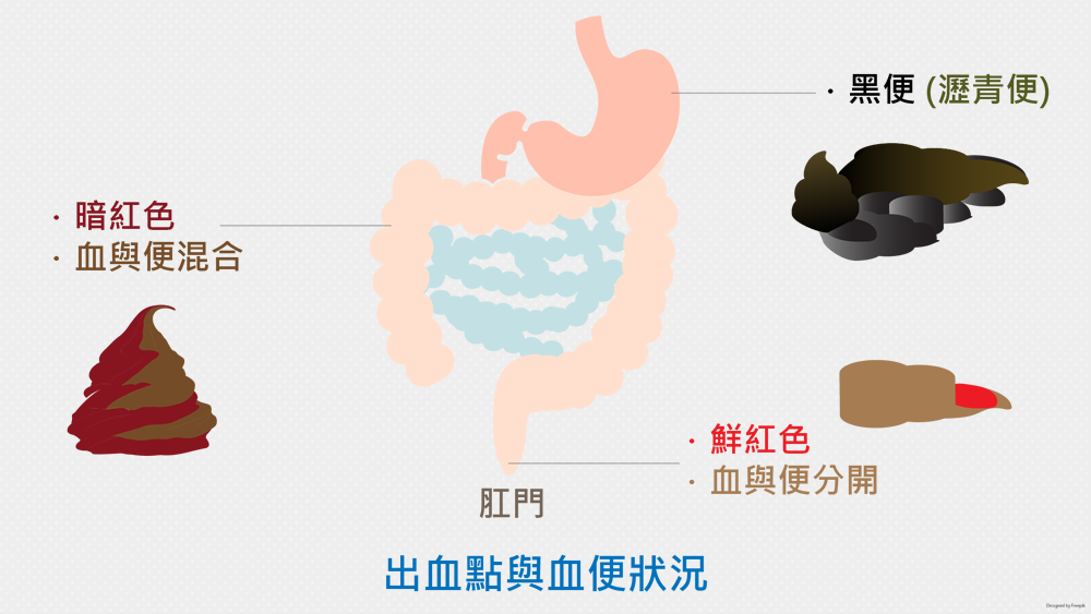 血便 消化道出血 火龍果 鐵劑 李宜霖胃腸肝膽科