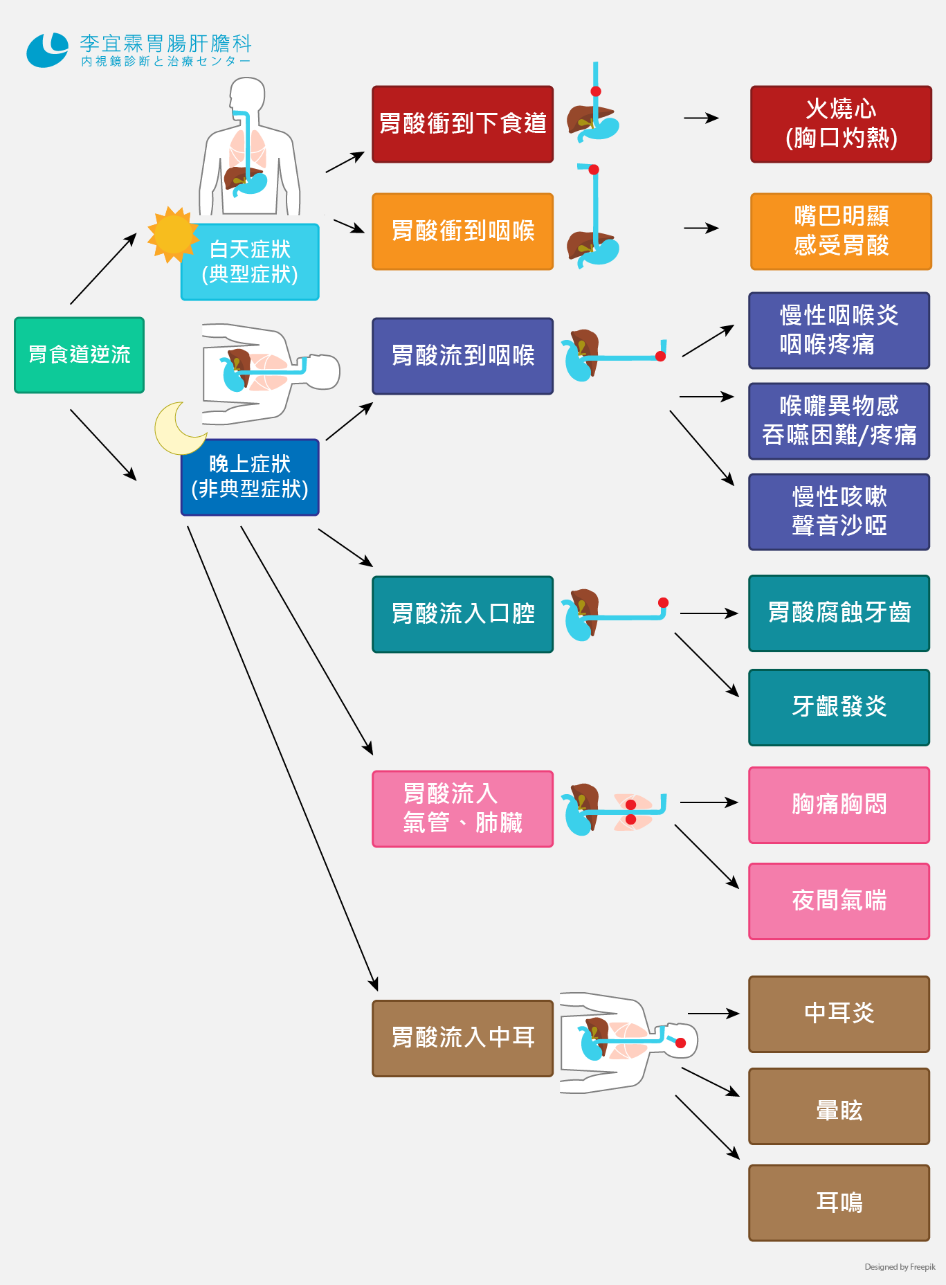 胃食道逆流 非典型症狀 李宜霖胃腸肝膽科