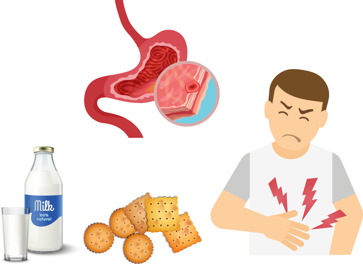潰瘍常見的迷思 李宜霖胃腸肝膽科