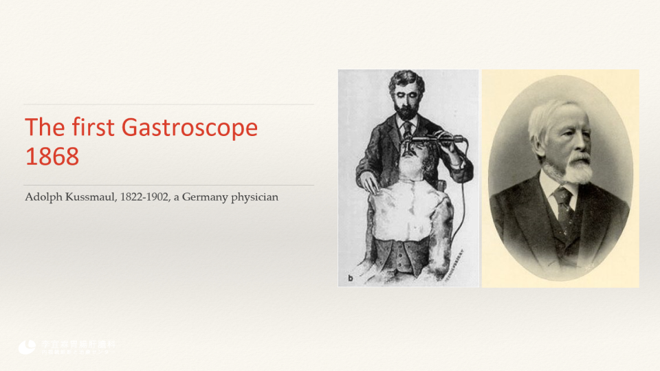 The first Gastroscope 1868, Adolph Kussmaul